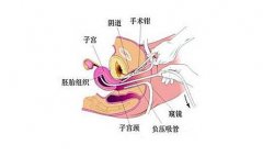 無痛人(rén)流的(de)危害有哪些